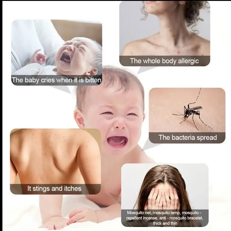 Bite Helper Safe Skin-friendly Antimosquito Bite Device Physical Antipruritic Instrument For Children Adults Pregnant Woman